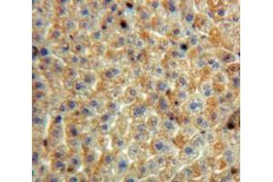 Used in DAB staining on fromalin fixed paraffin-embedded Liver tissue (SERPINB3 anticorps  (AA 1-210))