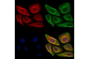 ABIN6260850 and ABIN6273034 staining Hela cells by IF/ICC.