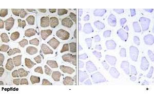 Immunohistochemistry analysis of paraffin-embedded human skeletal muscle tissue using SLC16A12 polyclonal antibody . (SLC16A12 anticorps)