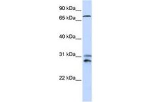Image no. 1 for anti-Tousled-Like Kinase 2 (TLK2) (AA 176-225) antibody (ABIN6744261) (TLK2 anticorps  (AA 176-225))
