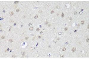 Immunohistochemistry of paraffin-embedded Rat brain using CTCF Polyclonal Antibody at dilution of 1:200 (40x lens).