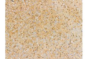 ABIN6257890 and ABIN6274946 at 1/100 staining Rat brain tissue by IHC-P. (CAGE1 anticorps  (C-Term))