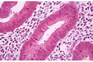 Anti-GALNT7 antibody IHC staining of human uterus, endometrium. (GALNT7 anticorps)
