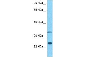 Host:  Rabbit  Target Name:  NCS1  Sample Type:  MDA-MB-435s Whole Cell lysates  Antibody Dilution:  1. (NCS1 anticorps  (N-Term))
