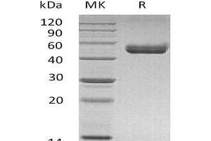Western Blotting (WB) image for HLA-DR-gamma (CD74) protein (His tag,mFc Tag) (ABIN7320543)