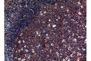 Immunohistochemistry (IHC) analysis of paraffin-embedded Human Tonsils, antibody was diluted at 1:100.