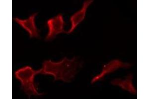 ABIN6275866 staining COLO205 by IF/ICC.