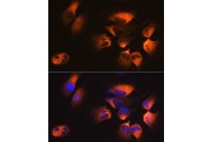 Immunofluorescence analysis of U-251MG cells using M1 Rabbit mAb (ABIN7265448) at dilution of 1:100 (40x lens).