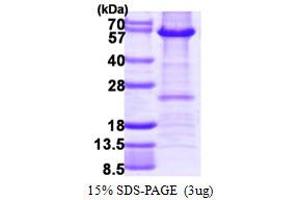 SDS-PAGE (SDS) image for Histone Deacetylase 2 (HDAC2) (AA 1-488) protein (His tag) (ABIN667944)