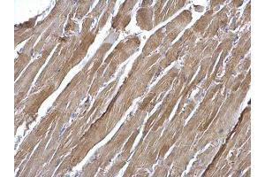 IHC-P Image NFkB p65 antibody detects NFkB p65 protein at cytosol on mouse heart by immunohistochemical analysis.