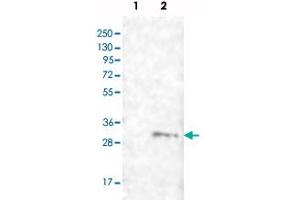 Western blot analysis of Lane 1: Negative control (vector only transfected HEK293T lysate), Lane 2: Over-expression lysate (Co-expressed with a C-terminal myc-DDK tag (~3. (FAM82B anticorps)