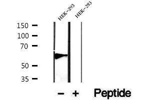 Western blot analysis of extracts of HEK-293 cells, using PHF17 antibody. (PHF17 anticorps  (C-Term))