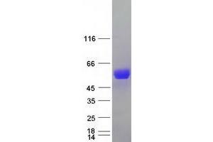 Validation with Western Blot