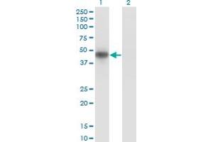 Western Blot analysis of MKNK2 expression in transfected 293T cell line by MKNK2 monoclonal antibody (M04), clone 4F11.