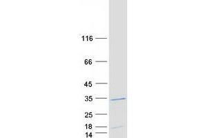 Validation with Western Blot