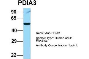 Host: Rabbit  Target Name: PDIA3  Sample Tissue: Human Adult Placenta  Antibody Dilution: 1.