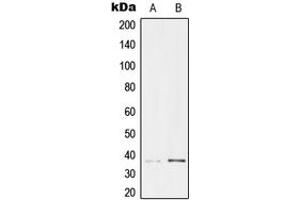 Western blot analysis of TCF19 expression in HeLa (A), HEK293 (B) whole cell lysates. (TCF19 anticorps  (Center))