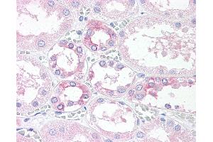 Anti-TM9SF4 antibody IHC of human, kidney.