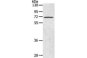 Western blot analysis of Human fetal brain tissue, using LTA4H Polyclonal Antibody at dilution of 1:500 (LTA4H anticorps)