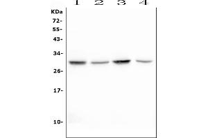 Western blot analysis of EPO using anti-EPO antibody (ABIN6719435).