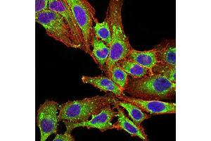 Immunofluorescence analysis of SK-OV-3 cells using PLD2 mouse mAb (green).