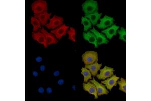 ABIN7093777 and ABIN7097818 staining HepG2 cells by IF/ICC. (IL-1 beta anticorps)
