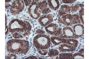 Image no. 9 for anti-IlvB (Bacterial Acetolactate Synthase)-Like (ILVBL) antibody (ABIN1498878) (ILVBL anticorps)