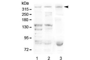 Western blot testing of Dystrophin antibody and Lane 1:  human SMMC-7721 (Dystrophin anticorps  (AA 3076-3404))