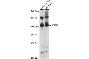 Western blot analysis of extracts of various cell lines, using SEPT12 antibody (ABIN6291643) at 1:1000 dilution. (Septin 12 anticorps)