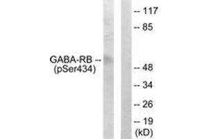 Western blot analysis of extracts from COS7 cells, using GABA-RB (Phospho-Ser434) Antibody. (GABA-RB (AA 401-450), (pSer434) anticorps)