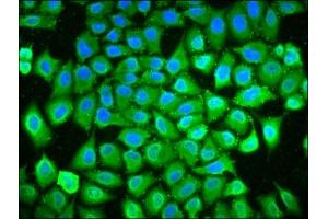 Immunofluorescence staining of Hela cells with ABIN7163852 at 1:133, counter-stained with DAPI. (POLDIP3 anticorps  (AA 100-221))
