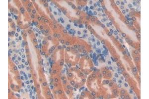 Detection of TUBd in Mouse Kidney Tissue using Polyclonal Antibody to Tubulin Delta (TUBd)