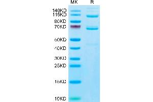 Human Complement component 3 Protein on Tris-Bis PAGE under reduced condition.