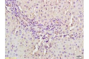 Formalin-fixed and paraffin embedded rat liver labeled with Anti- MASP2 Polyclonal Antibody, Unconjugated (ABIN676223) at 1:200, followed by conjugation to the secondary antibody and DAB staining.