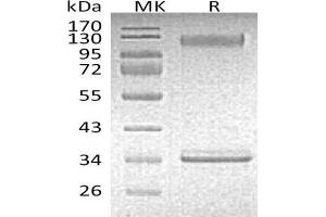 Western Blotting (WB) image for Selectin P (Granule Membrane Protein 140kDa, Antigen CD62) (SELP) protein (Fc Tag) (ABIN7320781)