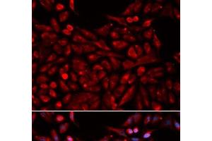 Immunofluorescence analysis of U2OS cells using NR1I3 Polyclonal Antibody (NR1I3 anticorps)