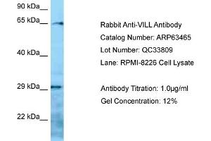Western Blotting (WB) image for anti-Villin-Like (VILL) (N-Term) antibody (ABIN2789509) (VILL anticorps  (N-Term))
