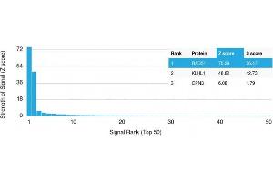 Analysis of Protein Array containing more than 19,000 full-length human proteins using RAD51 Mouse Monoclonal Antibody (RAD51/2701) Z- and S- Score: The Z-score represents the strength of a signal that a monoclonal antibody (MAb) (in combination with a fluorescently-tagged anti-IgG secondary antibody) produces when binding to a particular protein on the HuProtTM array.