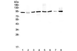 Western blot testing of human 1) HeLa 2) placenta, 3) MCF7, 4) A549, 5) SK-OV-3, 6) 22RV1, 7) A431 and 8) COLO320 lysate with UBA2 antibody at 0. (UBA2 anticorps)
