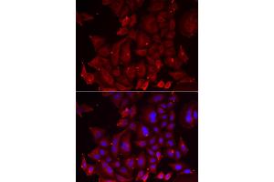 Immunofluorescence analysis of U2OS cells using PANX1 antibody (ABIN6290774). (PANX1 anticorps)