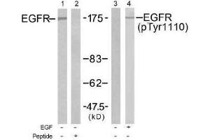 Image no. 1 for anti-Epidermal Growth Factor Receptor (EGFR) (pTyr1110) antibody (ABIN197027) (EGFR anticorps  (pTyr1110))