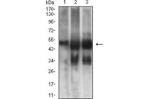 Western blot analysis using TUBB3 mouse mAb against NIH/3T3 (1), Hela (2), and A549 (3) cell lysate. (TUBB3 anticorps)