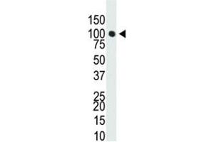 Western blot analysis of Dnmt3a antibody in T47-D cell lysate. (DNMT3A anticorps  (AA 457-486))