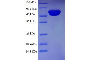 SDS-PAGE (SDS) image for neonatal Fc Receptor (FcRn) (AA 24-297), (Extracellular) protein (GST tag) (ABIN5709509)
