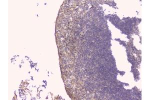 IHC analysis of TNFRSF11B using anti-TNFRSF11B antibody (ABIN7600875).