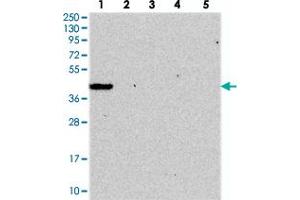 Western blot analysis of Lane 1: RT-4, Lane 2: U-251 MG, Lane 3: Human Plasma, Lane 4: Liver, Lane 5: Tonsil with GIMAP1 polyclonal antibody . (GTPase, IMAP Family Member 1 (GIMAP1) anticorps)
