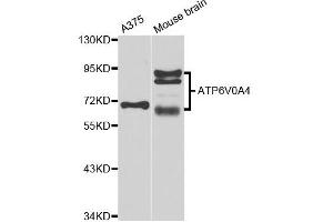 Western blot analysis of extracts of A375 and mouse brain cell lines, using ATP6V0A4 antibody.