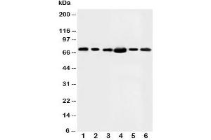 Western blot testing of FAF1 antibody and Lane 1:  rat testis;  2: MM453;  3: MM231;  4: HeLa;  5: SMMC-7721;  6: SW620 (FAF1 anticorps  (N-Term))