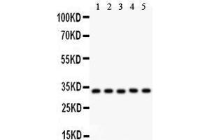 Anti- HMOX1 antibody, Western blotting All lanes: Anti HMOX1  at 0. (HMOX1 anticorps  (AA 1-288))