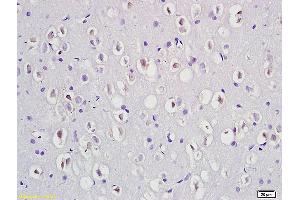 Formalin-fixed and paraffin embedded rat brain labeled with Anti-Phospho-Dab1 (Tyr232) Polyclonal Antibody, Unconjugated (ABIN684343) at 1:200 followed by conjugation to the secondary antibody and DAB staining (DAB1 anticorps  (pTyr232))